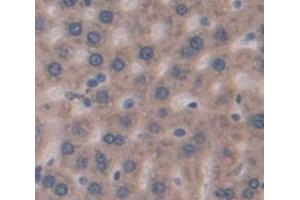 Immunohistochemistry (IHC) image for anti-C-Reactive Protein (CRP) (AA 20-230) antibody (ABIN1077879)