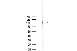 Western blot analysis of lysates from 293 cells(LPS 4h treatment), using Phospho-CtIP (Ser326) Antibody at 1/1000 dilution.