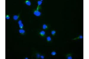 Image no. 4 for anti-Trafficking Protein Particle Complex 4 (TRAPPC4) antibody (ABIN1501264) (TRAPPC4 antibody)