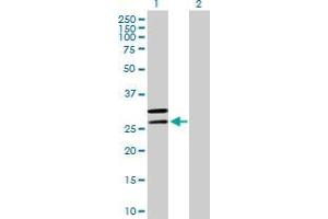 Lane 1: MRPL2 transfected lysate ( 33. (MRPL2 293T Cell Transient Overexpression Lysate(Denatured))