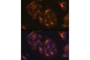 Immunofluorescence analysis of U-2 OS cells using Tubulin beta-1 chain Rabbit mAb (ABIN7271045) at dilution of 1:100 (40x lens). (TUBB1 antibody)