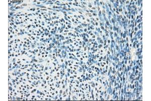Immunohistochemical staining of paraffin-embedded Ovary tissue using anti-PPP5Cmouse monoclonal antibody. (PP5 antibody)
