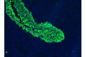 Image no. 3 for anti-Keratin 5/8 (KRT5/8) antibody (ABIN335325) (Keratin 5/8 antibody)