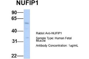 Host: Rabbit Target Name: NUFIP1 Sample Type: Human Fetal Muscle Antibody Dilution: 1. (NUFIP1 antibody  (N-Term))