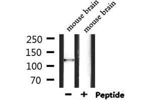 Western blot analysis of extracts from mouse brain, using CAMTA2 Antibody. (CAMTA2 antibody  (C-Term))