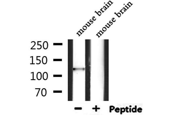 CAMTA2 antibody  (C-Term)