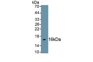 Detection of Recombinant CXCR4, Human using Polyclonal Antibody to Chemokine C-X-C-Motif Receptor 4 (CXCR4) (CXCR4 antibody  (AA 262-352))