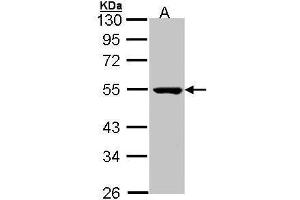 WB Image Sample (30 ug of whole cell lysate) A: Molt-4 , 10 % SDS PAGE antibody diluted at 1:1000 (PSKH1 antibody)