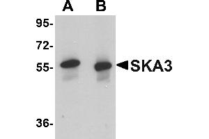 Western blot analysis of SKA3 in human testis tissue lysate with SKA3 antibody at (A) 0.
