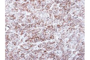 IHC-P Image Immunohistochemical analysis of paraffin-embedded SW480 xenograft, using Frizzled 8, antibody at 1:100 dilution. (FZD8 antibody  (C-Term))