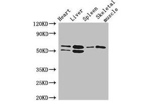 Western Blot Positive WB detected in: Mouse heart tissue, Mouse liver tissue, Mouse spleen tissue, Mouse skeletal muscle tissue All lanes: SLC15A3 antibody at 5 μg/mL Secondary Goat polyclonal to rabbit IgG at 1/50000 dilution Predicted band size: 64 kDa Observed band size: 64, 50 kDa (SLC15A3 antibody  (AA 253-309))