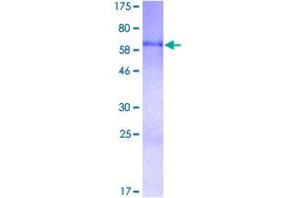 CYR61 Protein (AA 1-381) (GST tag)