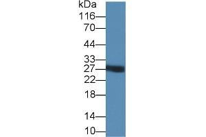 Detection of TRY in PANC1 cell lysate using Polyclonal Antibody to Trypsin (TRY) (Trypsin antibody  (AA 9-231))