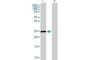 Western Blot analysis of RPIA expression in transfected 293T cell line by RPIA MaxPab polyclonal antibody. (Ribose 5-Phosphate Isomerase A (RPIA) (AA 1-237) antibody)