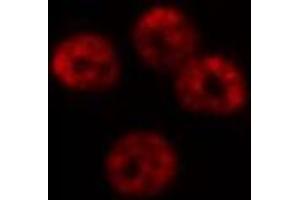 Immunofluorescence (fixed cells) (IF/ICC) image for anti-NDC80 Kinetochore Complex Component Homolog (NDC80) (C-Term) antibody (ABIN6263548)