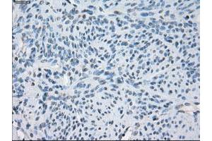 Image no. 2 for anti-Fc gamma RII (CD32) antibody (ABIN1497257) (Fc gamma RII (CD32) antibody)