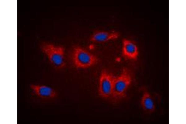 LATH antibody  (Center)