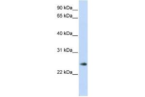 THYN1 antibody used at 1 ug/ml to detect target protein.