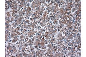 Immunohistochemistry (IHC) image for anti-Transient Receptor Potential Cation Channel, Subfamily M, Member 4 (TRPM4) antibody (ABIN1501531) (TRPM4 antibody)