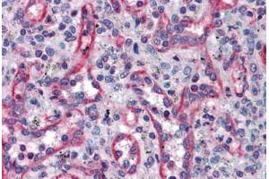 Human Spleen: Formalin-Fixed, Paraffin-Embedded (FFPE) (TUBA4A antibody  (AA 1-449))