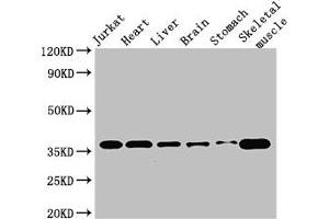 Western Blot Positive WB detected in: Jurkat whole cell lysate, Mouse heart tissue, Mouse brain tissue, Mouse kidney tissue, Mouse stomach tissue, Mouse skeletal muscle tissue All lanes: USE1 antibody at 2. (UBE2Z antibody  (AA 1-146))