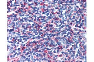 Immunohistochemistry (IHC) image for anti-Prostaglandin D2 Receptor 2 (PTGDR2) (Extracellular Domain) antibody (ABIN1048826)