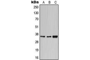Western blot analysis of CD1e expression in HeLa (A), SP2/0 (B), H9C2 (C) whole cell lysates.