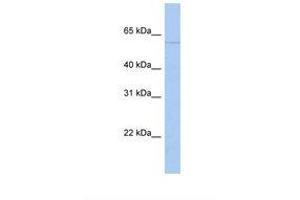 PAPD4 antibody  (AA 74-123)