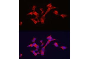Immunofluorescence analysis of SH-SY5Y cells using BSCL2 antibody (ABIN7265874) at dilution of 1:100. (BSCL2 antibody  (AA 50-150))