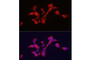 Immunofluorescence analysis of SH-SY5Y cells using BSCL2 antibody (ABIN7265874) at dilution of 1:100. (BSCL2 antibody  (AA 50-150))