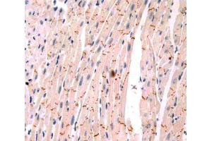 IHC-P analysis of heart tissue, with DAB staining. (PIM1 antibody  (AA 122-261))
