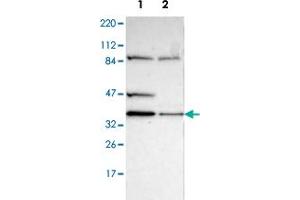 Western blot analysis of Lane 1: Human cell line RT-4; Lane 2: Human cell line U-251MG sp with DSN1 polyclonal antibody  at 1:100-1:250 dilution. (DSN1 antibody)