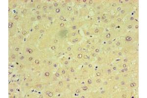 Immunohistochemistry of paraffin-embedded human liver tissue using ABIN7159923 at dilution of 1:100 (CHCHD4 antibody  (AA 1-142))