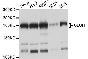 Western blot analysis of extracts of various cell lines, using CLUH antibody (ABIN6003838) at 1/1000 dilution. (CLUH antibody)