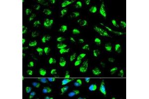 Immunofluorescence analysis of HeLa cells using ECI1 Polyclonal Antibody (DCI antibody)