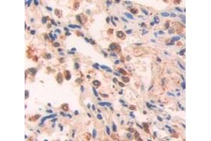 Figure. (SIRT7 antibody  (AA 1-400))