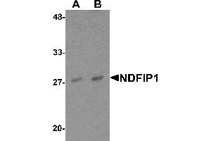 Western blot analysis of NDFIP1 in PC-3 cell lysate with NDFIP1 antibody at (A) 0. (NDFIP1 antibody  (N-Term))