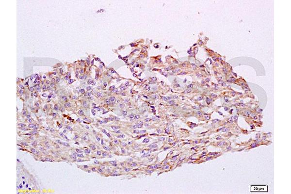 CYP24A1 antibody  (AA 351-450)