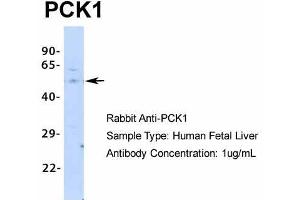 Host:  Rabbit  Target Name:  PCK1  Sample Type:  Human Fetal Liver  Antibody Dilution:  1. (PCK1 antibody  (Middle Region))
