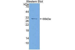 Figure. (PTPRJ antibody  (AA 1033-1277))