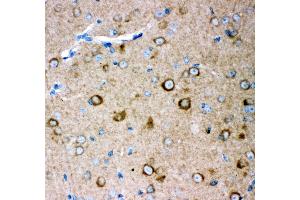 Anti- GRIA2 antibody, IHC(P) IHC(P): Mouse Brain Tissue (GRIA2 antibody  (AA 25-360))
