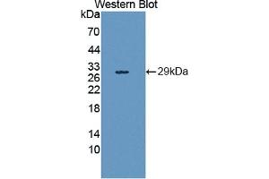 Detection of Recombinant HAND1, Human using Polyclonal Antibody to Heart And Neural Crest Derivatives Expressed Protein 1 (HAND1) (HAND1 antibody  (AA 1-215))