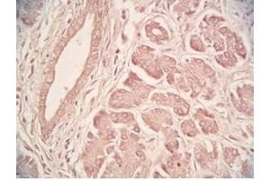 Human pancreas tissue was stained by Rabbit Anti-Urocortin II (Human) Serum (Urocortin 2 antibody  (amidated))
