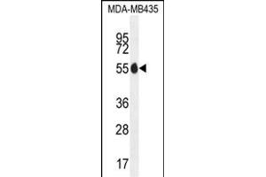 X1 Antibody (N-term) (ABIN655649 and ABIN2845124) western blot analysis in MDA-M cell line lysates (35 μg/lane). (PAX1 antibody  (N-Term))
