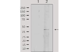 Western blot analysis of extracts from rat brain, using Collagen IV α2 Antibody. (COL4a2 antibody  (N-Term))