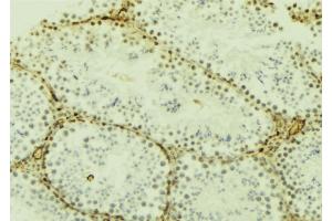 ABIN6277187 at 1/100 staining Mouse testis tissue by IHC-P. (DNMT3L antibody  (Internal Region))