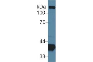 Western Blotting (WB) image for anti-Aldolase A, Fructose-Bisphosphate (ALDOA) (AA 18-273) antibody (ABIN7440131)
