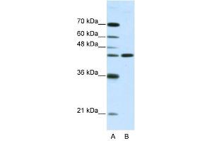 NMUR2 antibody used at 2. (NMUR2 antibody  (N-Term))