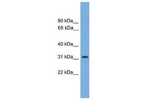 DAPP1 antibody used at 1 ug/ml to detect target protein.