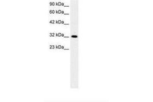 Image no. 1 for anti-E2F5 (E2F5) (AA 134-183) antibody (ABIN6736272) (E2F5 antibody  (AA 134-183))